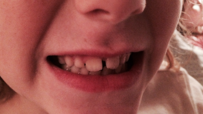 My Child Has Knocked Their Tooth Out!