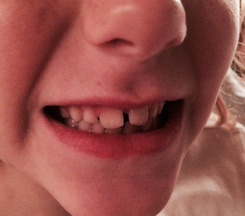 My Child Has Knocked Their Tooth Out!