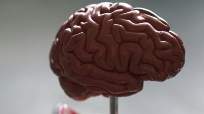 Brain Health: Unlocking Dementia Prevention